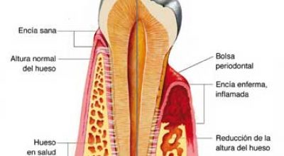 endodoncia1.jpg