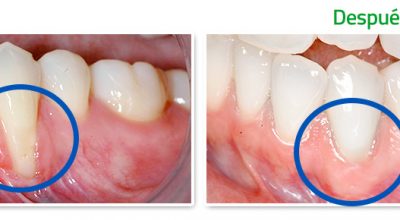 periodoncia1.jpg