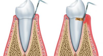 periodoncia4.jpg